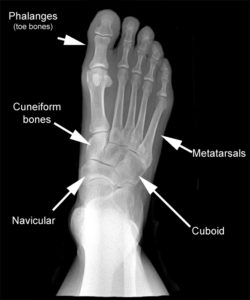 foot-xr-normal-ap-with-text3 – Drwolgin