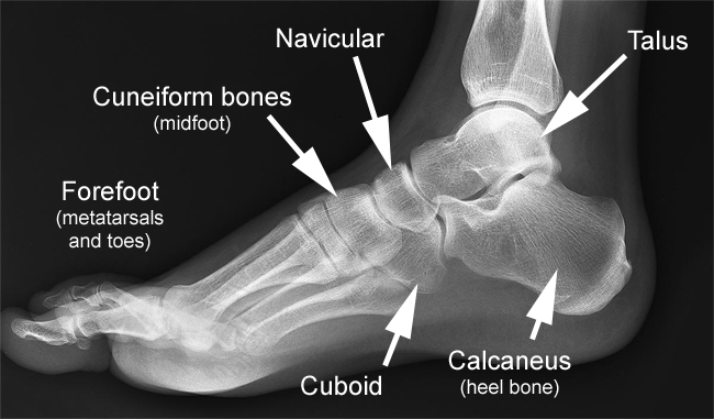 foot-xr-normal-lat-w-text4 – Drwolgin