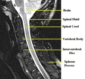 Cervical Anatomy - Drwolgin